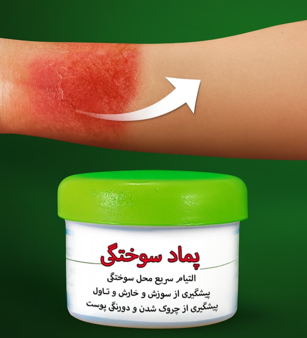 پماد سوختگی و التیام پوست